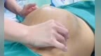 横位+脐带绕颈两周！产科专家天团48小时守护 孕妇逆袭顺产