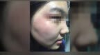 武汉17岁女生与男同学冲突中被打致颅脑损伤，学校：多部门已介入处理