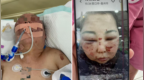 被前夫打进<em>ICU</em>女子情况仍不稳定，其8岁女儿也曾遭父亲扇脸，律师：已构成故意伤害罪