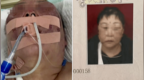 女子遭前夫殴打致肠破裂住进<em>ICU</em>，警方回应