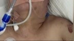 43岁女子遭前夫殴打住进<em>ICU</em>后死亡，警方最新通报：受害人死亡，嫌犯已被逮捕