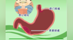 胃癌不是“绕不开的坎”　这些“护胃密码”快收藏