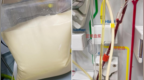 小伙血液突然变成白色，确诊3种致命病症，进EICU置换3000毫升血浆