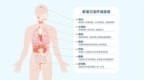 “肿瘤狙击手” 以前自费十几万，现在医保报销！射波刀到底有多牛？
