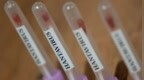 安第斯病毒致死率超30%，疾控提示别这样打扫卫生