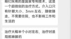 没有诊断编码的病，手术排到了 4 个月后，竟然还能用国补？