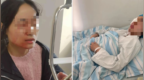 女教师劝架被六年级女生用镊子戳伤眼球，学校通报
