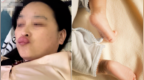 姥姥不听劝亲吻婴儿脚丫，结果不小心染上脚气，嘴唇红肿如香肠！医生提醒