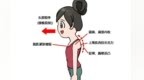 告别“乌龟颈”　拯救上交叉综合症