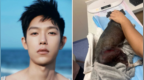 演员称养了7年的爱犬遭人恶意砍伤，正在抢救生死未卜