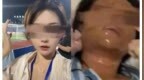 男子追求女主播不成多次报复：扎车胎、泼强酸、放置爆炸物