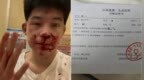 17岁男生遭假警察骗出门殴打，被诊断抑郁