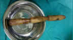 7旬大爷便秘用木棍疏通致肠穿孔，医生：粪便已经开始污染腹腔