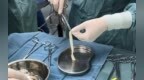 济南南郊医院全周期守护女性健康，3D生物束带紧缩术破解盆底损伤难题