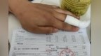 看健 | 治疗1厘米伤口花4400元，到底贵不贵？