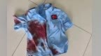 伤者脖颈喷血命悬一线！危急时刻，他脱下警服充当“止血带”