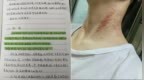 “记不清第几次被勒脖子了”，女护士遭男友杀害案二审开庭，生前日记还原暴力细节