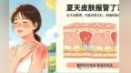 夏天皮肤报警了？出汗加暴晒　这些误区快避开