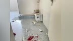 湖北恩施一医院拖把池倾倒碎裂致男童左大腿肌腱断裂 多方回应