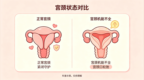 宫颈“生命之门”孕22周意外松动濒临流产  多学科协作为胎儿抢回8周生长时间