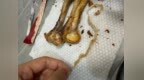 陈阿炳风干鸭小腿疑现麻绳，消费者称“麻绳藏在肉里，嚼不动”，客服：可能没有打捞卤料包