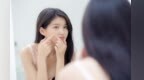 95%的人都会长痘　专家解锁科学战痘真相
