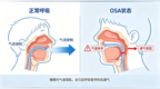 孩子打鼾≠睡得香，儿童睡眠呼吸问题，正在悄悄影响孩子成长