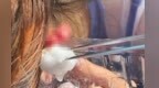 南昌18岁女生玩剧本杀遭店员“公主抱”失手 在医院缝了十几针