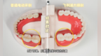 电动牙刷功能内卷的热潮之下，飞利浦以专业主义回归口腔健康护理本质