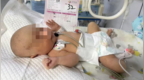 医院护工失手致新生儿颅骨骨折，家属拒绝一次性补偿