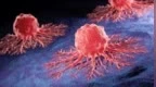 中国科研团队：一针纳米材料打进肿瘤，可让癌细胞“生锈死亡”