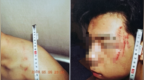 17岁男生遭假警察上门殴打，被强迫跪下磕头、叫爹