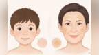 分清生活美容与医疗医美　科学祛斑不踩坑