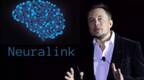 黑客帝国来了？马斯克搞“人脑植芯片”项目：头骨钻孔，插电极线