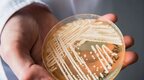 致命真菌在美国蔓延 近一半感染者90天内死亡