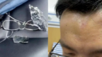 知情人：织金县委书记已探望被打记者，并承诺严惩打人者