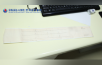 颅脑重度损伤合并心搏骤停世博高新医院急诊团队高效救治成功复苏