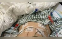 35岁两次抗癌，在等死的处境里，我对生活热爱得不行