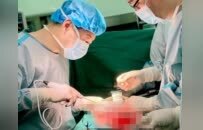 一场与“癌中之王”的博弈……