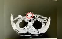 一枚金属零件击中颈部，二附院医生成功“拆弹”