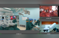 江苏省肿瘤医院结对帮扶淮安市肿瘤医院 家门口的优质诊疗服务从何而来？