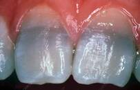 “鸡你太美”：欧洲曾用鸡头让狂犬病绝迹