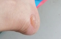 郑州富士康返乡员工：走了50公里，脚丫子磨破了