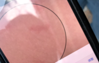 18岁女子酒后被性侵长裙检出精斑，网约车司机被取保