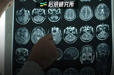 315能给质量差的“前额叶”也打个假吗？