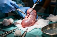 异种移植迎突破:美国启动人体移植基因编辑猪肾规模化临床试验