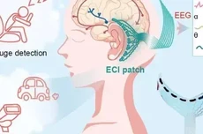 耳后脑机接口贴片问世，北理工、北航团队打造
