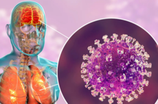 印度这致死率75%的尼帕病毒 真的会成为下一个新冠吗