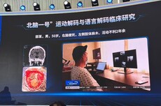 脑机接口站上风口,我们离“意念操控”还有多远?