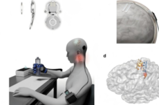 脑机接口，一场没有硝烟的算法战争